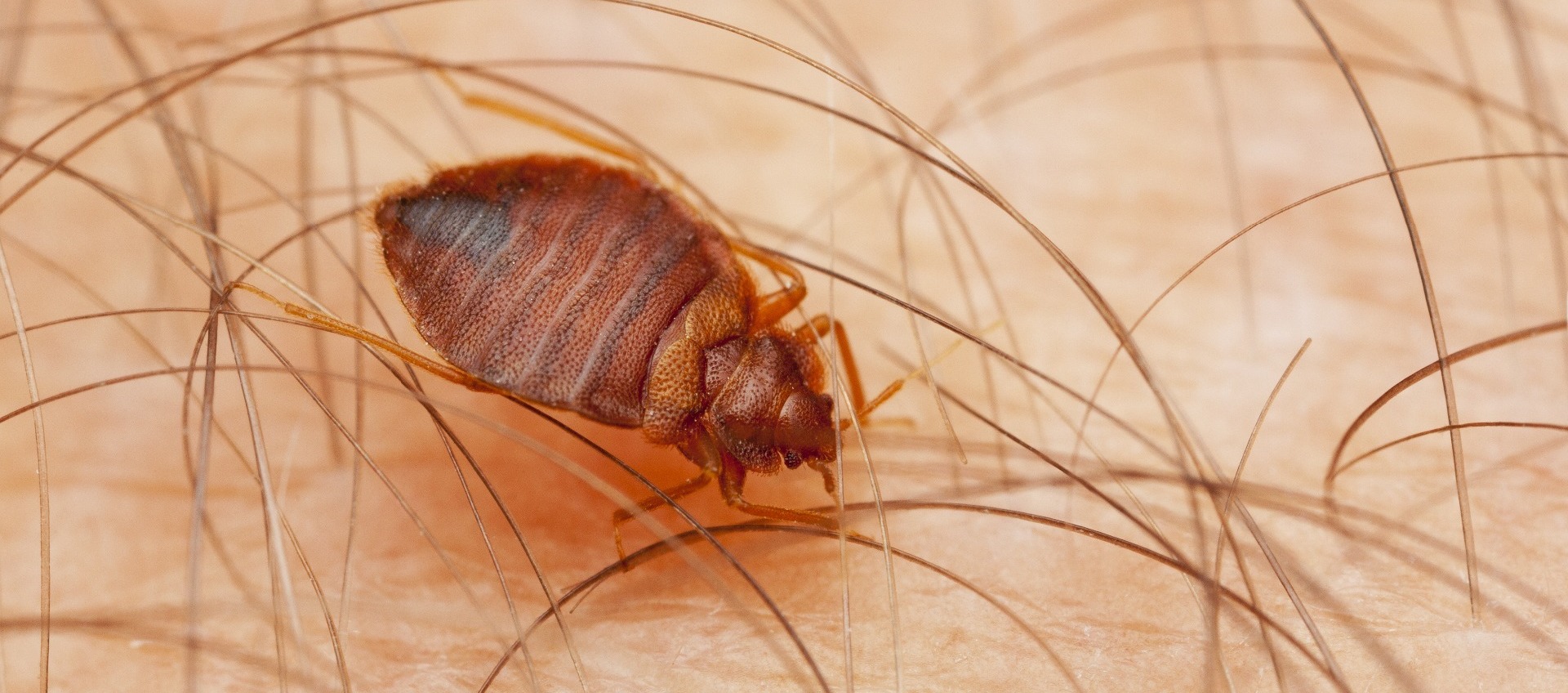 Bedbug on skin